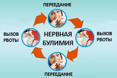 Лечение булимии в Гвардейске